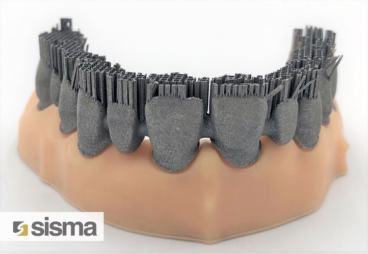 Dental arch after stress relieving vacuum heat treatment